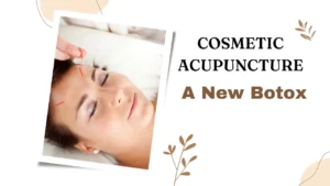 Cosmetic Acupuncture Service