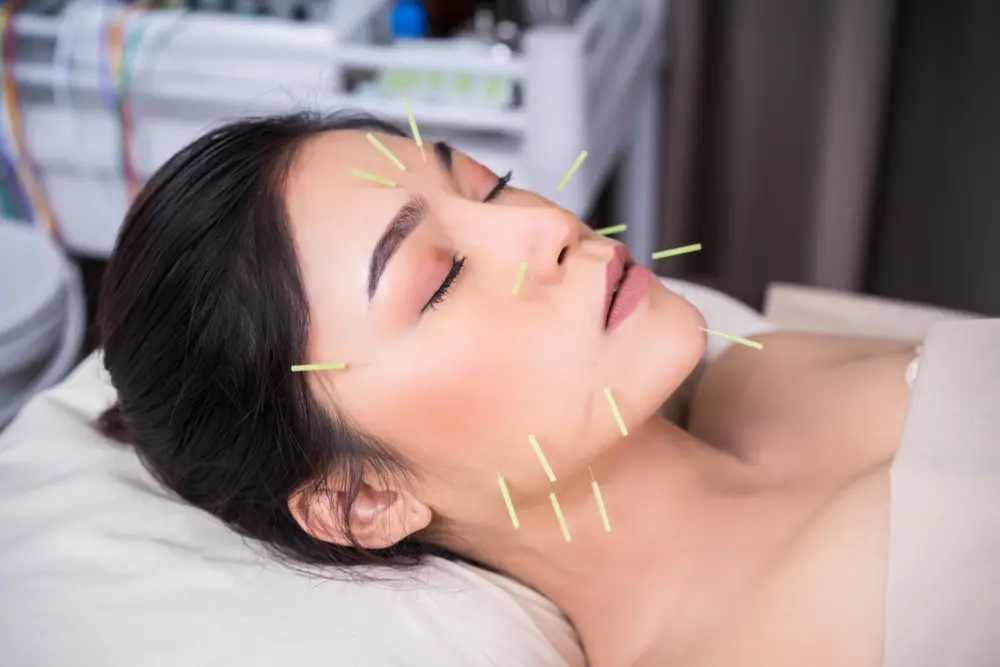 Cosmetic Acupuncture