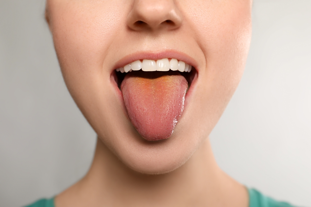 Tongue Diagnosis​ and treatment