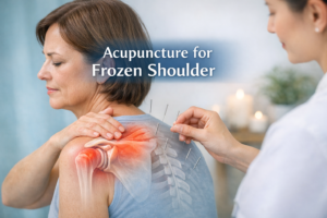 What Is Frozen Shoulder